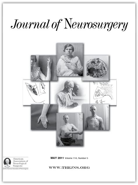 Dopamine Agonistresistant Prolactinomas In Journal Of Neurosurgery