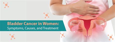 bladder cancer in women symptoms causes and treatment