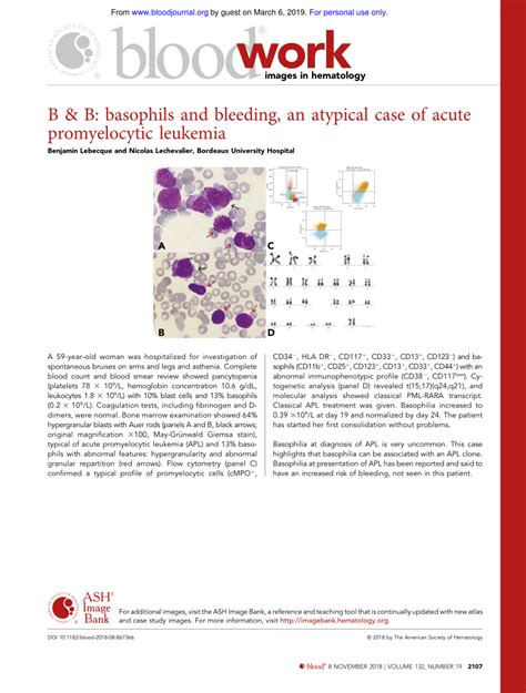 Pdf B And B Basophils And Bleeding An Atypical Case Of Acute