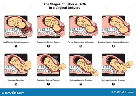 Stages Of Labor And Birth In A Vaginal Delivery Stock Vector Illustration Of Early Conceptual