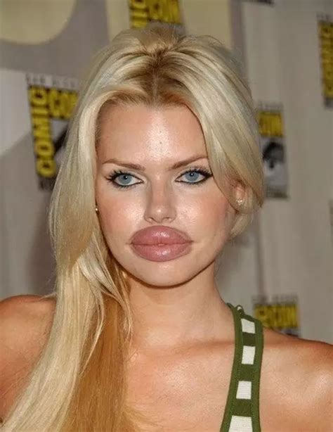 These People Are Definitely Unemployed Big Lips Natural Botox Lips