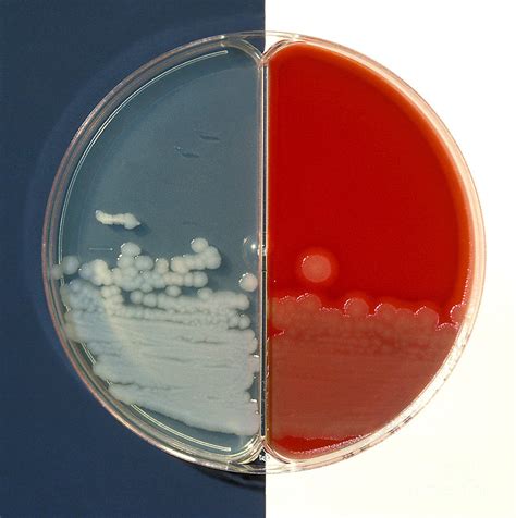 Bacillus Cereus Culture Photograph By Science Source