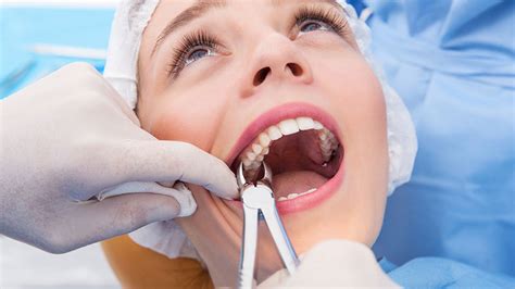 Extractions Lifecare Dental