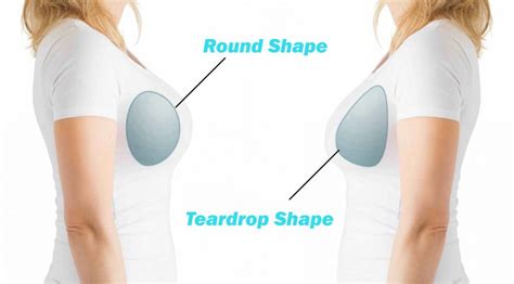 Natural Looking Breast Implants