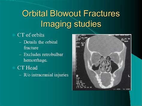 Maxillofacial Trauma By Daniel Cerbone D O St