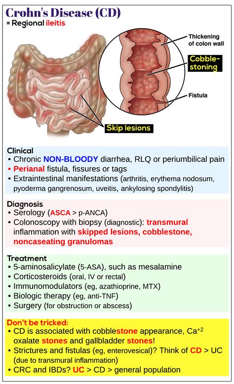 Crohn S Disease Medicine Keys For MRCPs