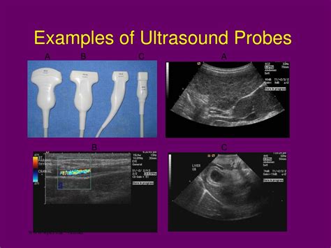 Ppt Ultrasonography Powerpoint Presentation Free Download Id623027