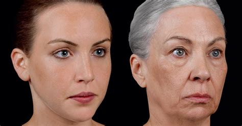 Understanding Your Aging Face Blog Baycare Clinic