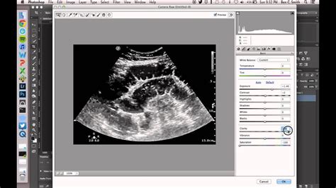 Enter the name, hospital, and date you'd like to appear on the fake ultrasound. Tutorial: Tweak Ultrasound Videos with Photoshop CC - YouTube