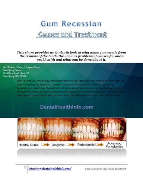 Gum Recession Causes And Treatment