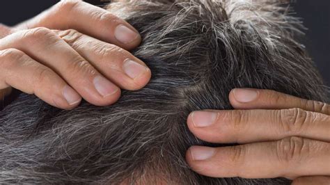 Why Does Hair Turn Gray Causes Scientific Explanations And Remedies