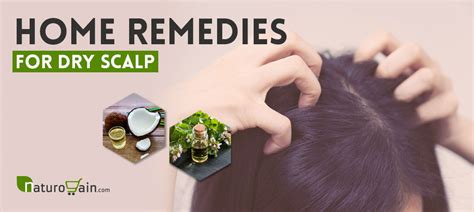 Top 6 Diy Home Remedies For Dry Scalp Get Rid Of Itchy Scalp