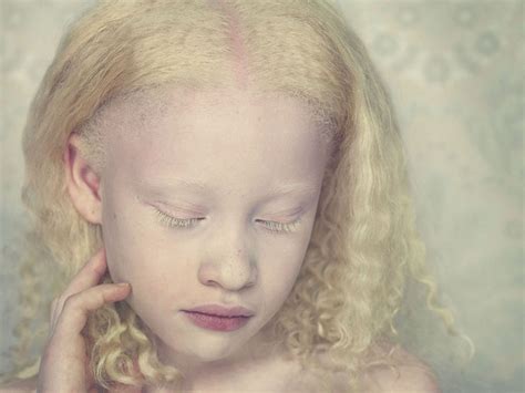 Albino Models Making Their Mark Opening Minds In Africa Huffpost