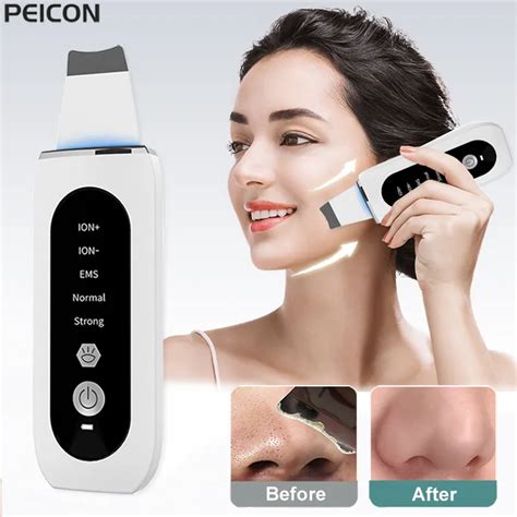 ultrasonic skin scrubber peeling blackhead remover deep face cleaning ultrasonic ion ance pore