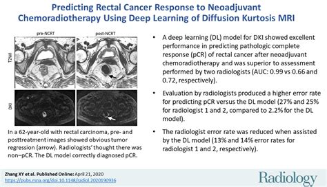 Predicting Rectal Cancer Response To Neoadjuvant Chemoradiotherapy