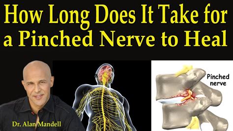 How Long Does It Take For A Pinched Nerve To Heal Dr Mandell Youtube