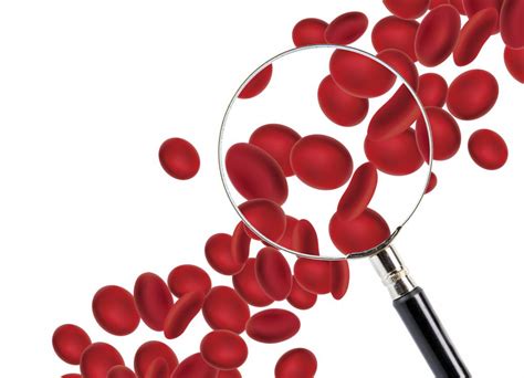 Low Red Blood Cell Count Symptoms Diet And Lifestyle Changes