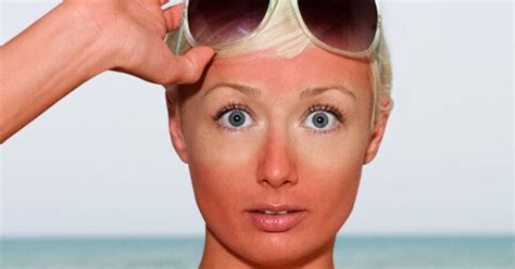 Summer Makeup Tips How To Cover Up A Sunburn Huffpost Style