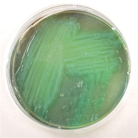 Pseudomonas Aeruginosa Microbiology Medbullets Step 1