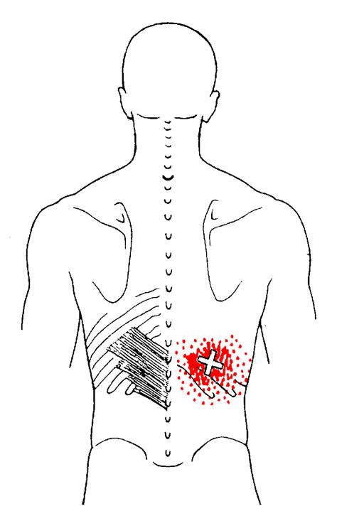 Serratus Posterior Inferior The Trigger Point And Referred Pain Guide