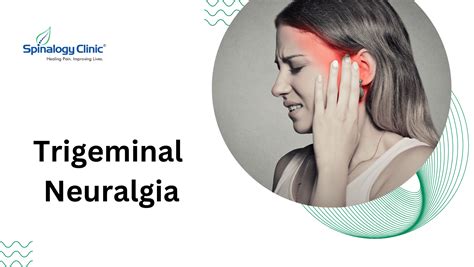 Understanding Trigeminal Neuralgia Causes Symptoms And Treatment Best