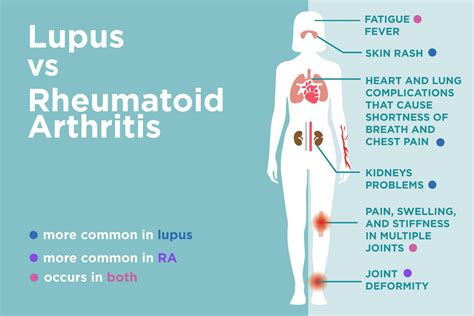 Rheumatoid Factor Rf Test 3 Types Risks And Results
