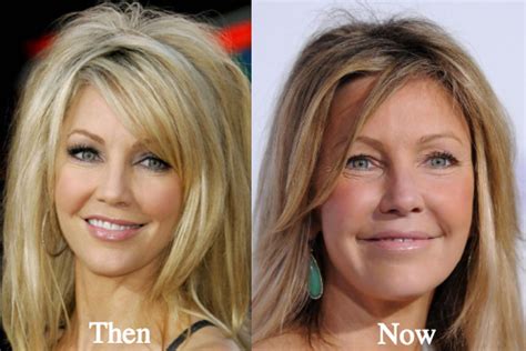 Heather Locklear Plastic Surgery Before And After Photos