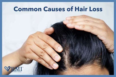 Common Causes Of Hair Loss Regenerative Medical Institute