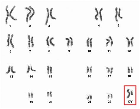 Difference Between Autosomes And Sex Chromosomes Compare The Difference Between Similar Terms