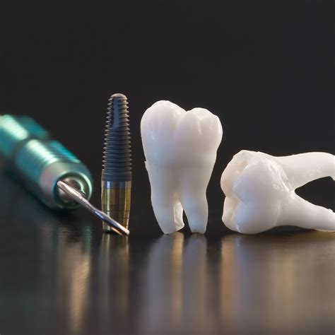 Implantes Dentários Em Aracaju Marque Uma Consulta Agora
