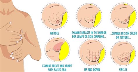 What to do with nits but no lice? How to Perform a Breast Self-Exam - Idaca