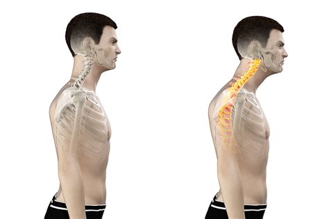 What Is Good Posture Dynamic Health Jersey Chiropractor