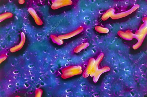 Coloured Sem Of Vibrio Cholerae Bacteria Stock Image B2200750