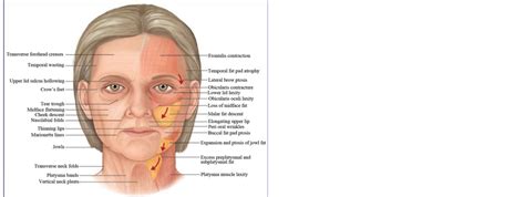 A Guide To Cheek Augmentation Single Point Deep Injection Of