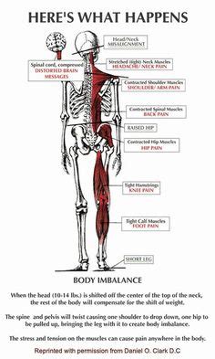 The anatomy of a floating rib. Back Pain Down Leg leg-pain-during-pregnancy-sciatica-varicose-veins.gif | Back Pain Down Leg ...