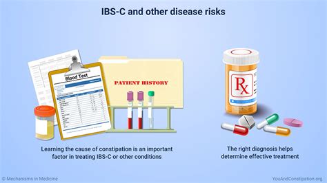 Slide Show Understanding Ibs With Constipation