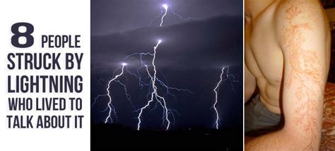 8 People Struck By Lightning Who Lived To Talk About It Lightning