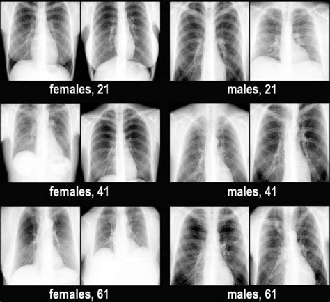 Examples Of Original Chest Radiographs Download Scientific Diagram