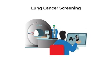 Lung Cancer Screening ~ Stat Cardiologist