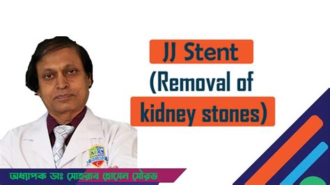 Jj Stent Removal Of Kidney Stones । হাসপাতাল Youtube