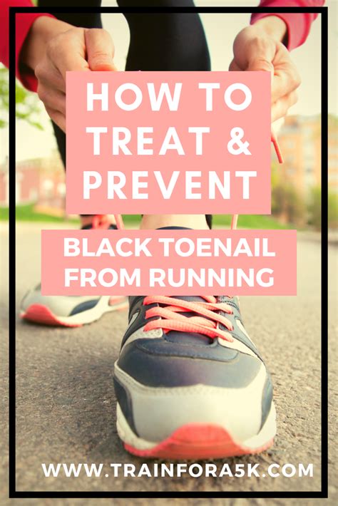 How To Prevent And Treat Black Toenail From Running Train For A