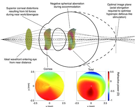 Schematic Of A Potential Mechanism Between Near Work And Myopia
