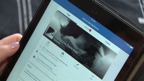 Self Harm St John S Woman Bares Scars On Facebook To End Stigma Cbc