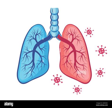 Arriba Imagen Dibujos De Enfermedades Del Sistema Respiratorio Cancunfitness Com Mx