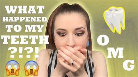 What Happened To My Teeth Thetarative Youtube