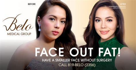 Julia Montes Before After