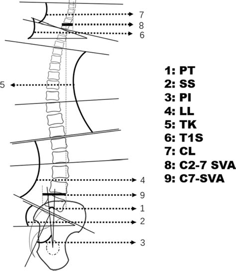 Method To Measure Spino Pelvic Sagittal Alignment Pt Pelvic Tilt Ss