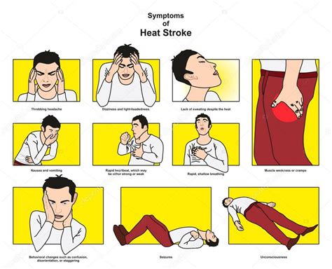 Symptoms Heat Stroke Infographic Diagram Including Headache Dizziness