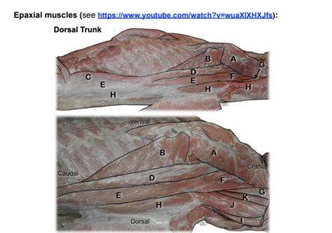 Epaxial Muscles Dorsal Trunk Diagram Quizlet