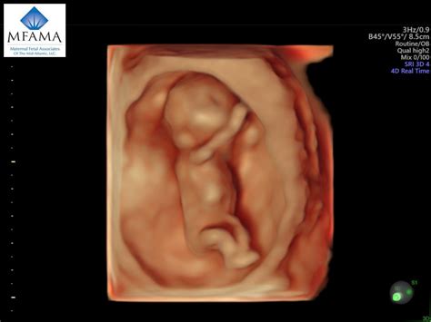 3d4d Ultrasound Maternal Fetal Associates Of The Mid Atlantic